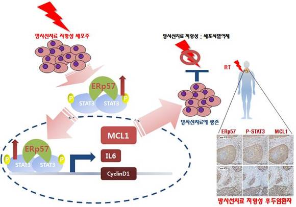 2. ERp57-STAT3 결합의 분자진단에 따른 생존율 예측