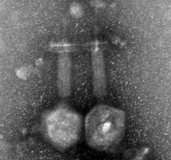 bacteriophage: ©Ronen Hazan / Hebrew University