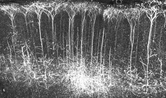 청각적 학습 훈련과 선조체에서의 시냅스 강화. ©Courtesy of Dr. Zador, Cold Spring Harbor Laboratory, N.Y.