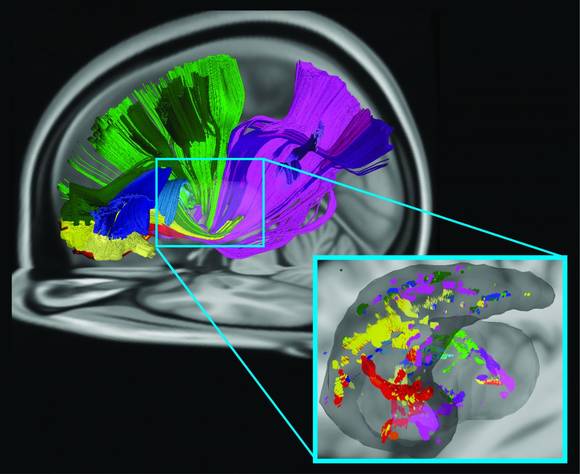 뇌 영역들간 구조적 기능적 연계성.©Carnegie Mellon University
