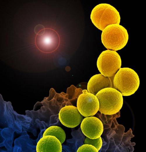그림 : 전자현미경으로 본 Staphylococcus aureus의 모습 ⒸNational Institute of Allergy and Infectious Diseases