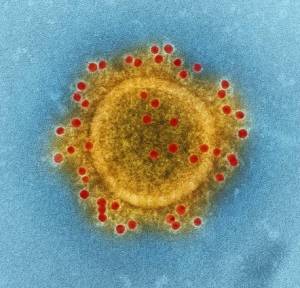 NIAID/CDC The coronavirus that causes MERS has not evolved to spread easily between humans.
