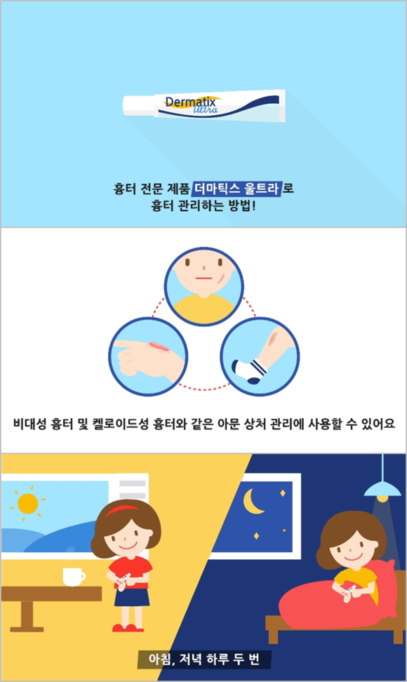 더마틱스 울트라 올바른 사용법 모션 그래픽 캡쳐