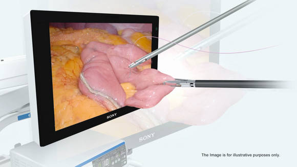 3D 복강경 시스템 컨셉 이미지