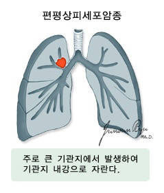 출처: 국가암정보센터