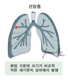 출처: 국가암정보센터