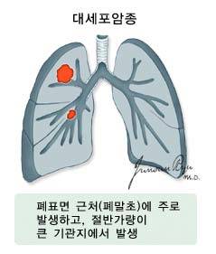 출처: 국가암정보센터