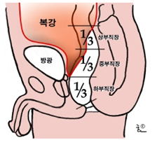 직장의 구조 : 자료 대한대장항문학회