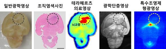 테라헤르츠 영상으로 일반광학영상이나 조직염색사진(병리검사사진), 광학단층영상(OTC 의료영상), 특수조영제 형광영상에 비해 뇌교종을 명확하게 확인할 수 있다.