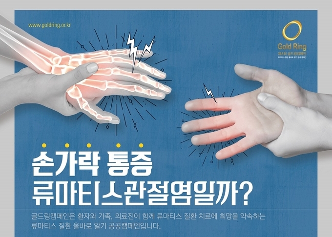 손가락마디통증, 류마티스관절염 치료 8