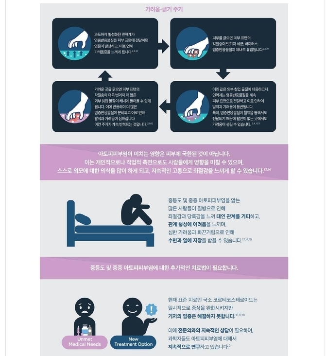 성인중증 아토피피부염