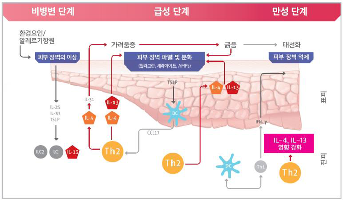 아토피피부염 발생기전