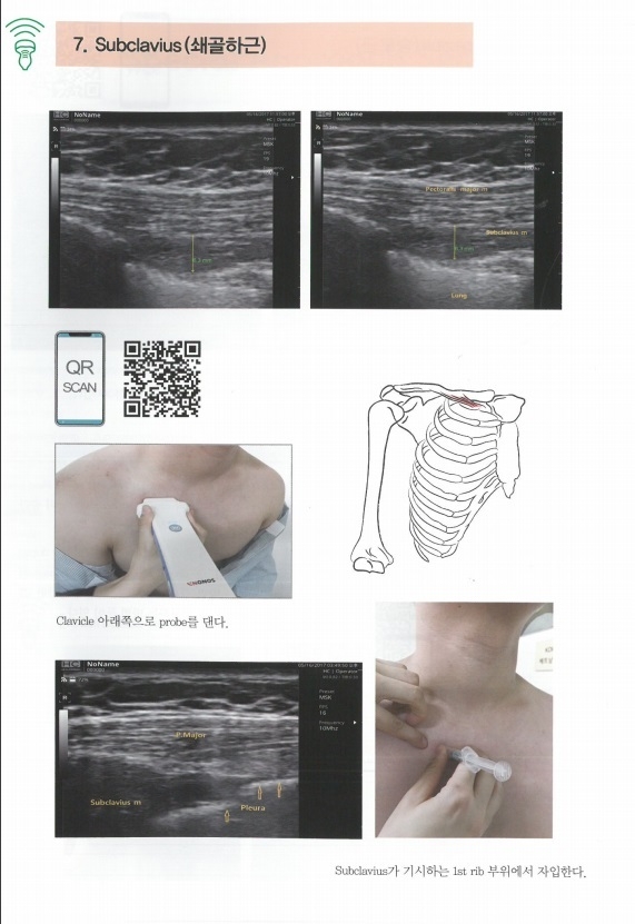 1. 소논을 활용한 통증진단법을 설명한 책 본문