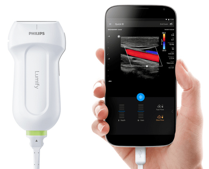 앱기반 모바일 초음파 루미파이(Lumify)
