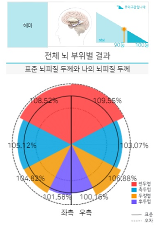 뇌노화 정밀 프로그램의 뇌분석 결과지 일부 (JLK인스펙션 제공)