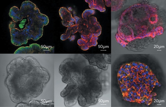 Korean Cell Line Bank (L−R) colorectal, pancreatic and breast cancer organoids.