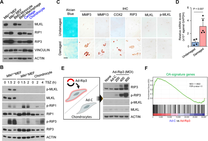 Figure 1 Non-canonical role of receptor-interacting protein kinase-3 (RIP3) in chondrocytes is related to osteoarthritis (OA) pathogenesis.