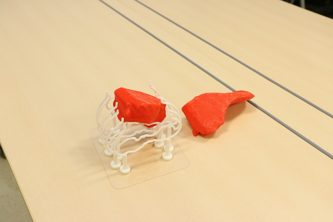 소아 간 3D 프린팅 모델 